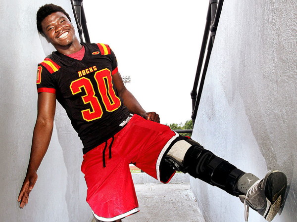 smiling young man with a brace on his leg